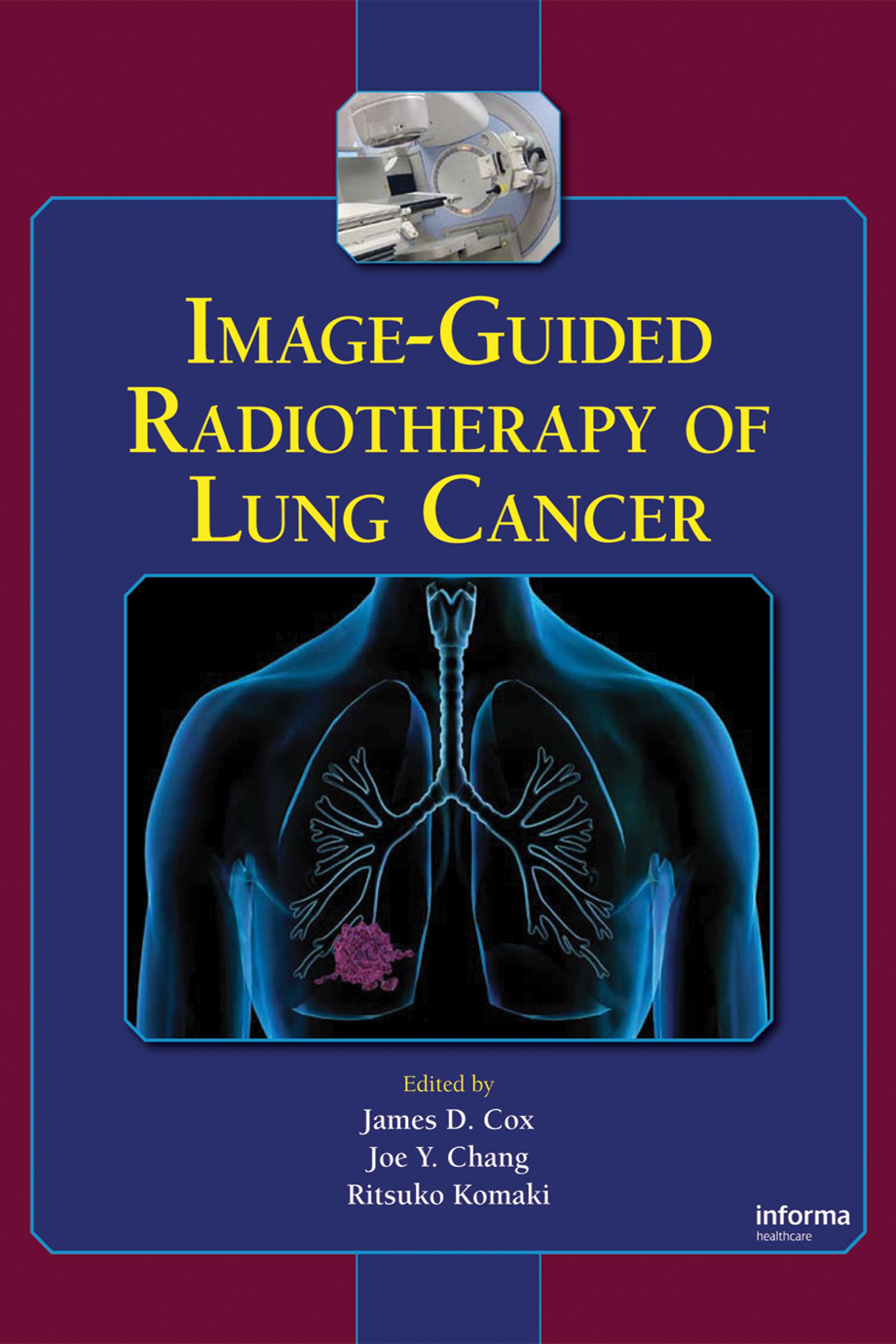 Image-Guided Radiotherapy of Lung Cancer
