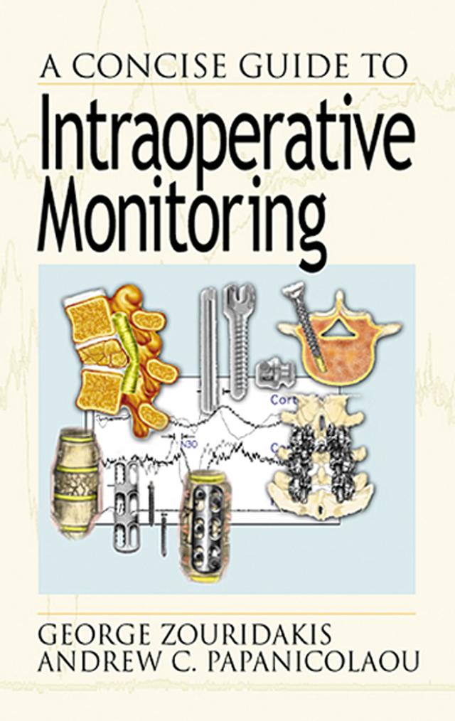 A Concise Guide to Intraoperative Monitoring by Andrew C. Papanicolaou, George Zouridakis