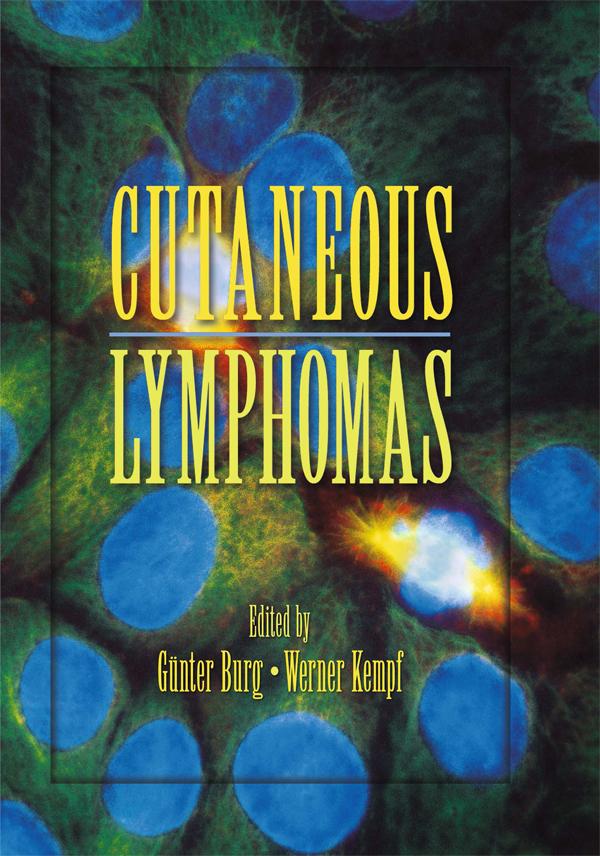 Cutaneous Lymphomas by Gunter Burg, Werner Kempf