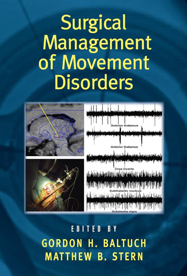 Surgical Management of Movement Disorders by Gordon H. Baltuch, Matthew B. Stern