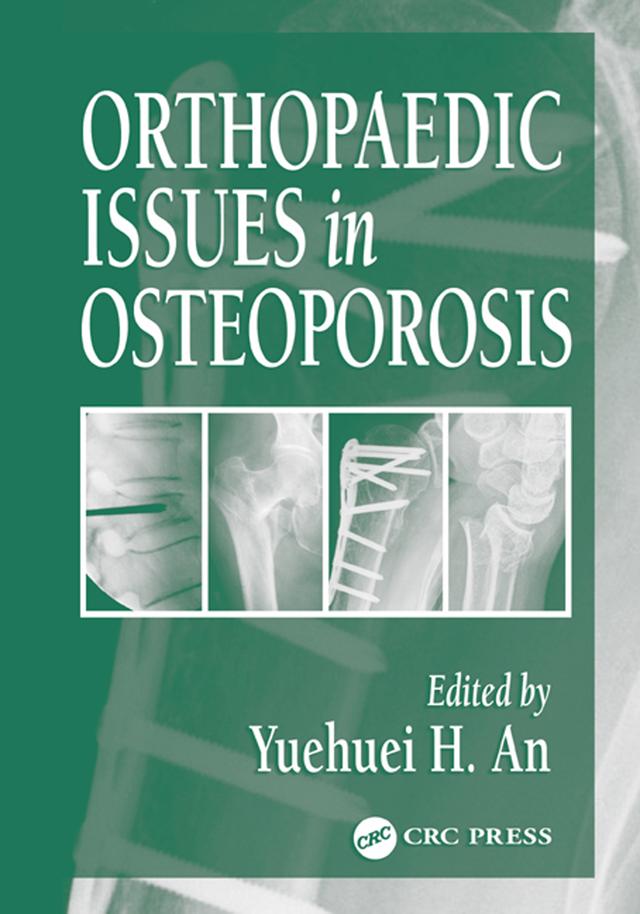 Orthopaedic Issues in Osteoporosis by Yuehuei H. An
