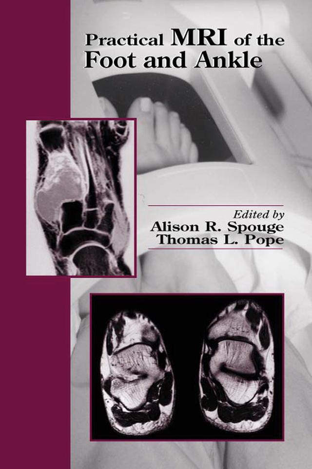 Practical MRI of the Foot and Ankle by Alison R. Spouge, Thomas L Pope