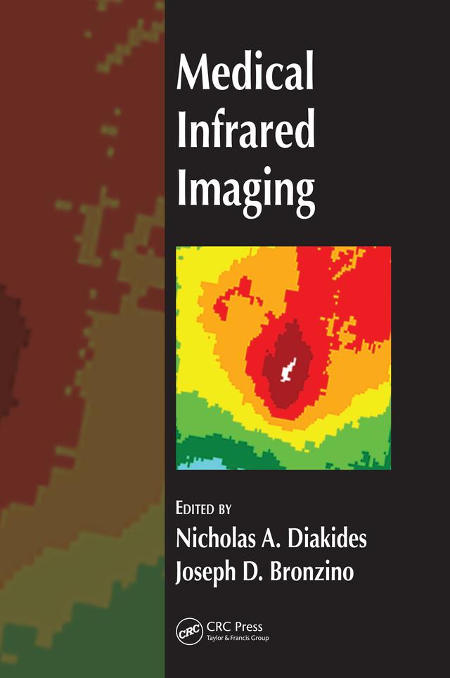 Medical Infrared Imaging by Joseph D. Bronzino, Nicholas A. Diakides