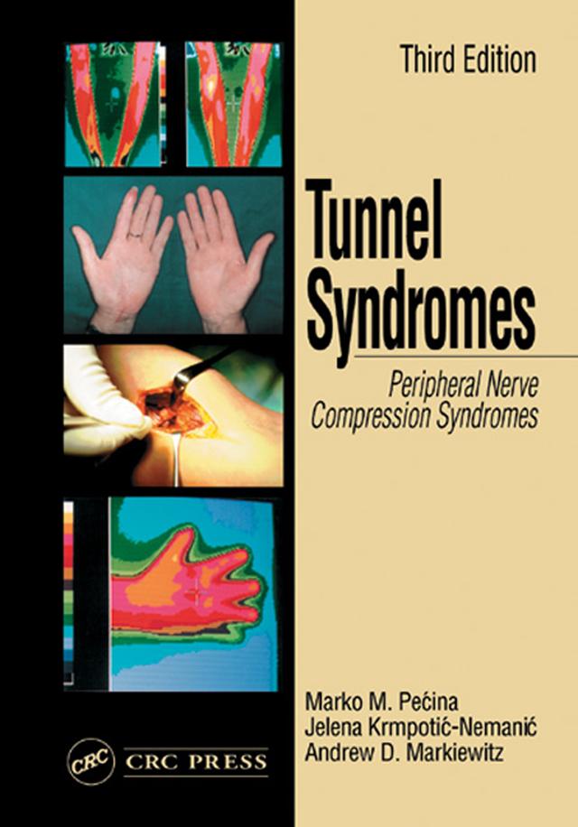 Tunnel Syndromes by Andrew D. Markiewitz, Jelena Krmpotic-Nemanic, Marko M. Pecina