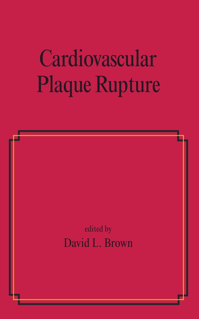 Cardiovascular Plaque Rupture by David L. Brown