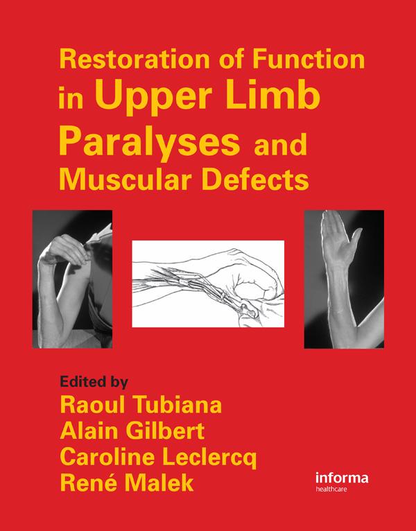 Restoration of Function in Upper Limb Paralyses and Muscular Defects by Alain Gilbert, Caroline Leclercq, Raoul Tubiana, Rene Malek