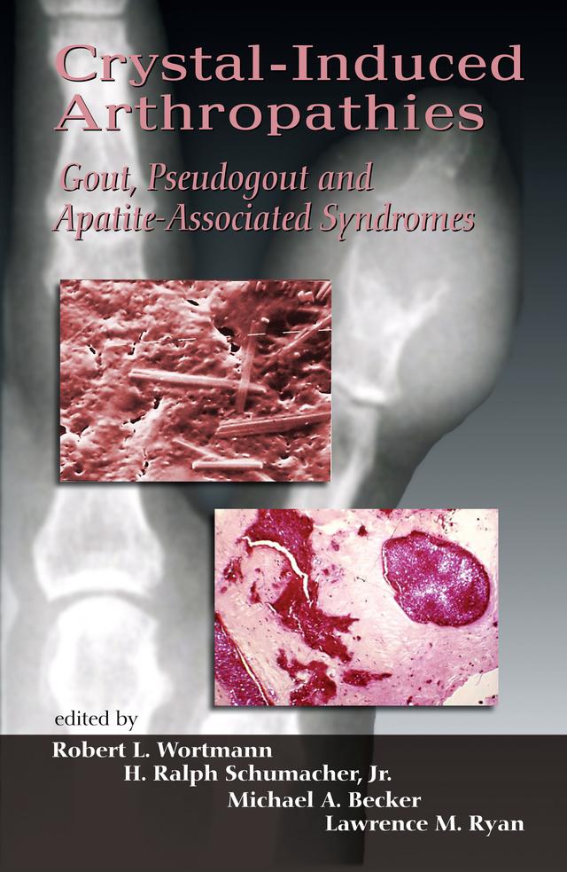 Crystal-Induced Arthropathies by H. Ralph Schumacher, Lawrence M. Ryan, Michael A. Becker, Robert L. Wortmann