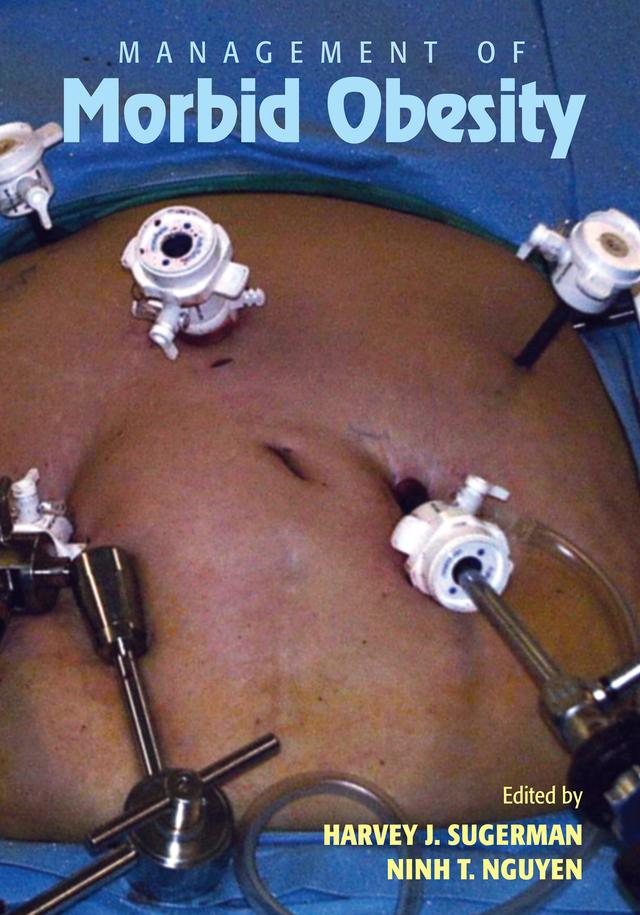 Management of Morbid Obesity by Harvey J. Sugerman, Ninh Nguyen