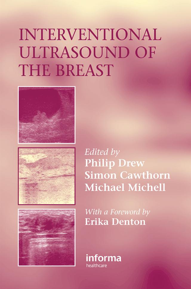 Interventional Ultrasound of the Breast by Michael Michell, Philip Drew, Simon Cawthorn