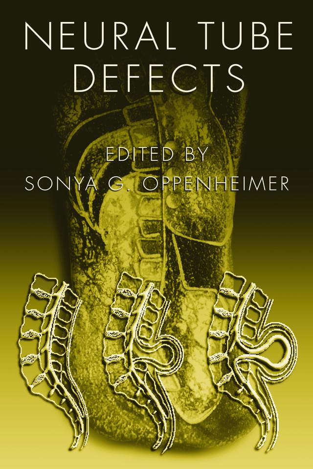 Neural Tube Defects by Sonya G. Oppenheimer