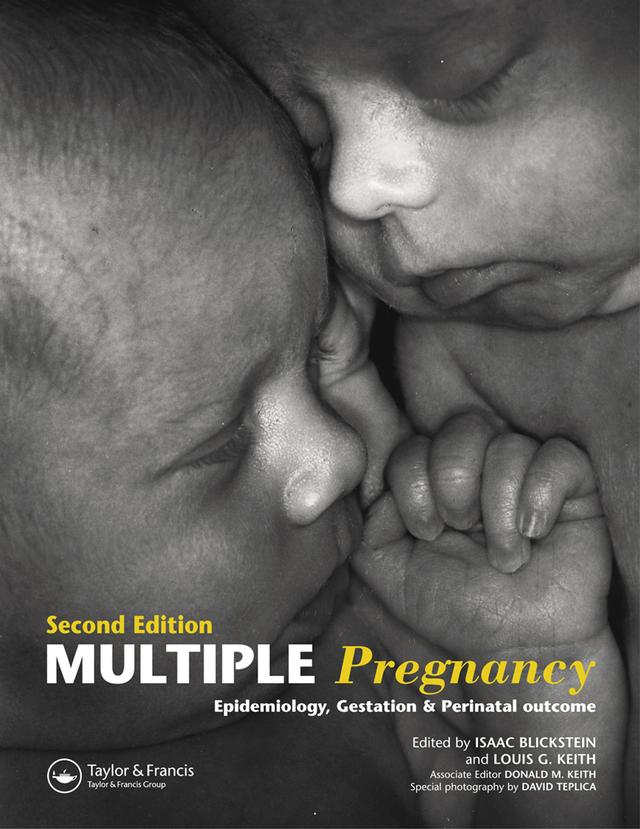 Multiple Pregnancy by Isaac Blickstein, Louis G. Keith