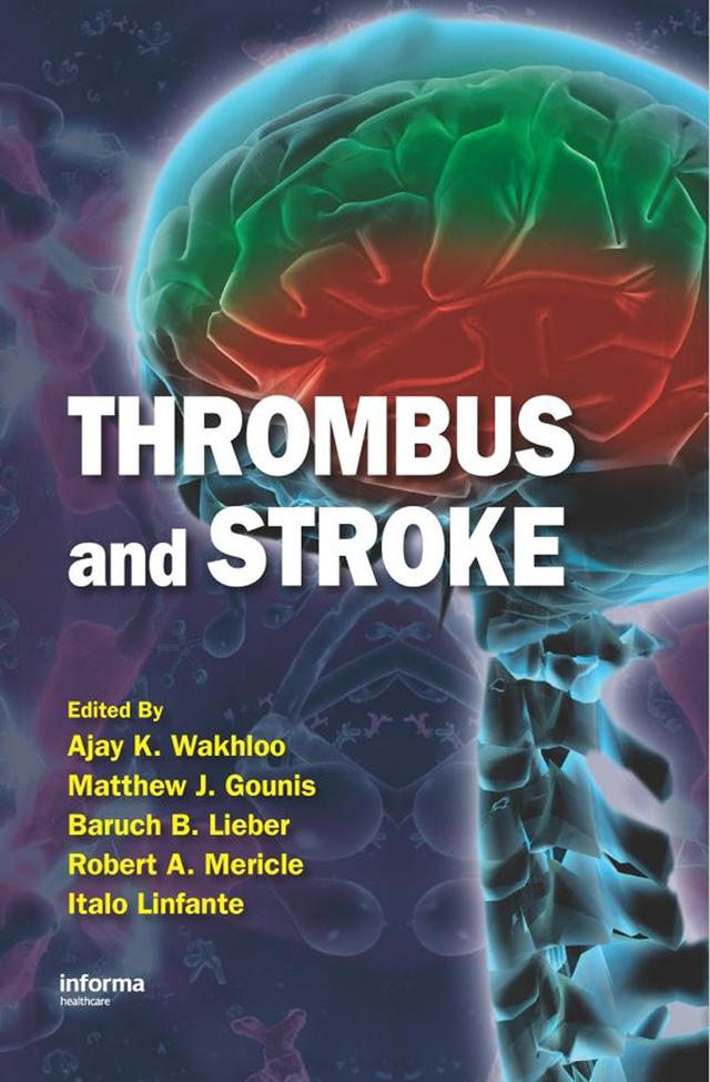 Thrombus and Stroke by Ajay K. Wakhloo, Baruch B. Lieber, Italo Linfante, Matthew J. Gounis, Robert A. Mericle