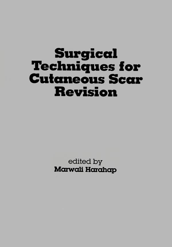 Surgical Techniques for Cutaneous Scar Revision by Marwali Harahap