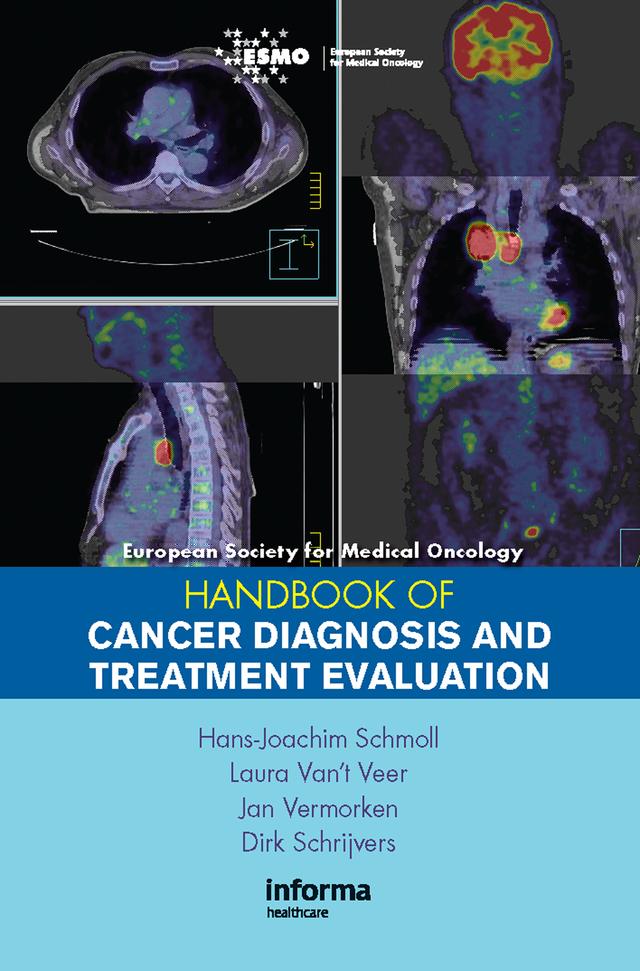 ESMO Handbook of Cancer Diagnosis and Treatment Evaluation by Dirk Schrijvers, Hans-Joachim Schmoll, Jan Vermorken, Laura Van't Meer