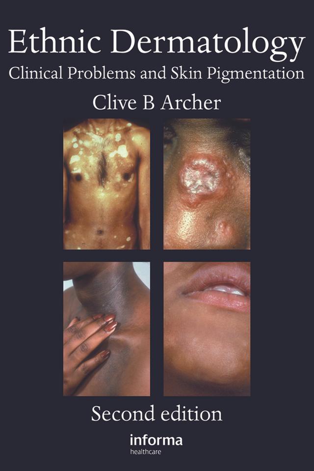 Ethnic Dermatology by Clive B. Archer