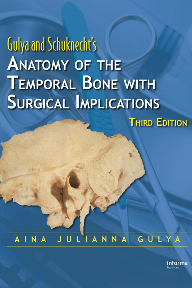 Anatomy of the Temporal Bone with Surgical Implications by Aina Julianna Gulya