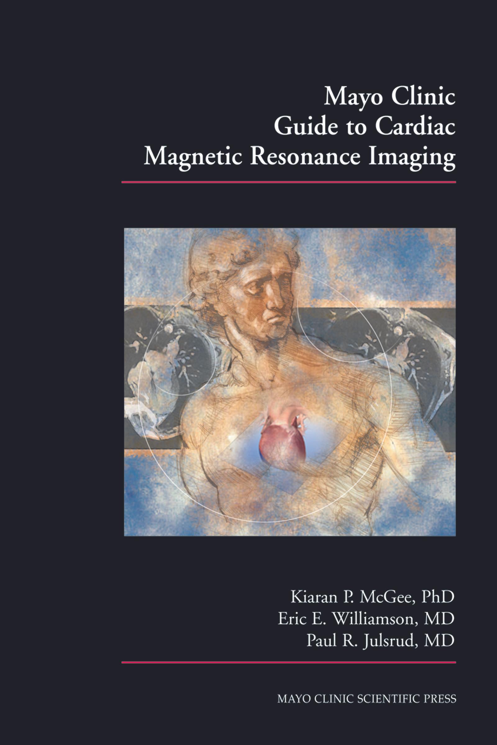 Mayo Clinic Guide to Cardiac Magnetic Resonance Imaging