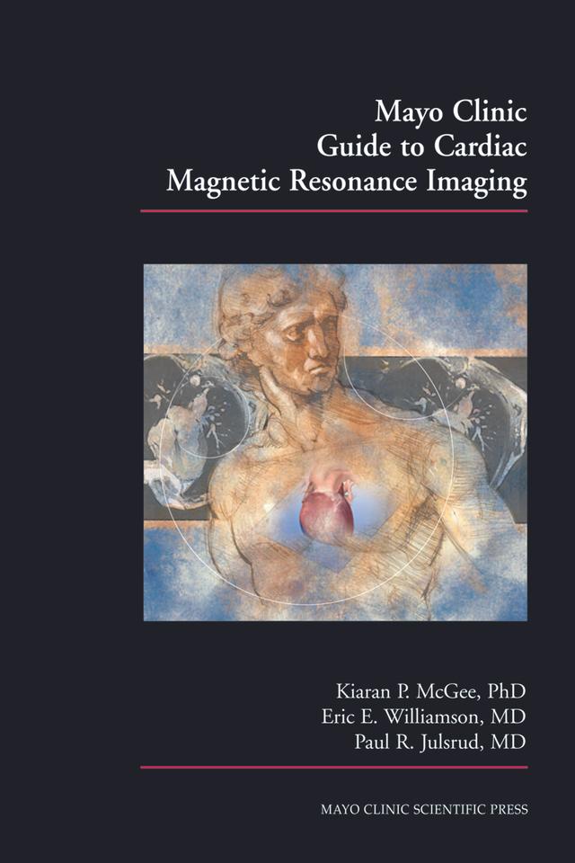 Mayo Clinic Guide to Cardiac Magnetic Resonance Imaging by Eric E. Williamson, Kiaran P. McGee, Paul Julsrud