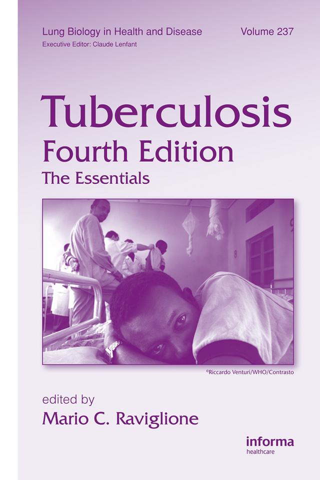 Tuberculosis by Mario C. Raviglione