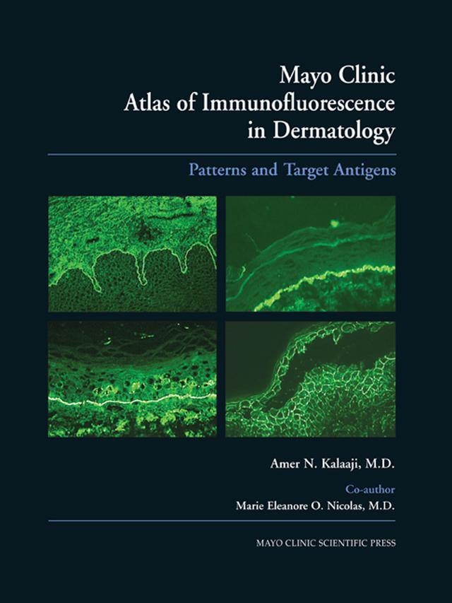 Mayo Clinic Atlas of Immunofluorescence in Dermatology by Amer N. Kalaaji, Marie E.O. Nicolas