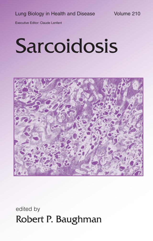 Sarcoidosis by Robert Baughman