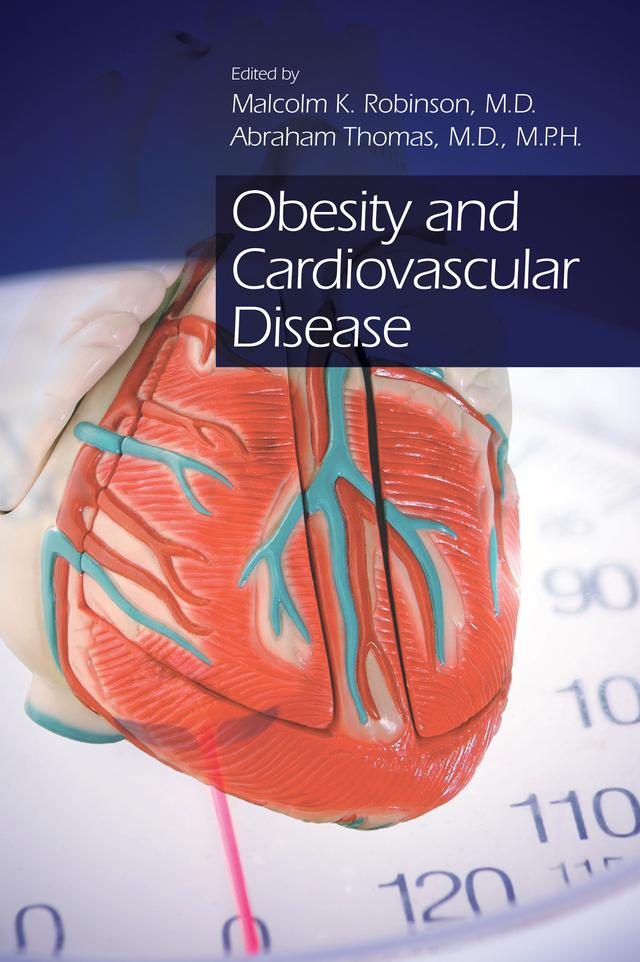 Obesity and Cardiovascular Disease by Abraham Thomas, Malcolm K Robinson