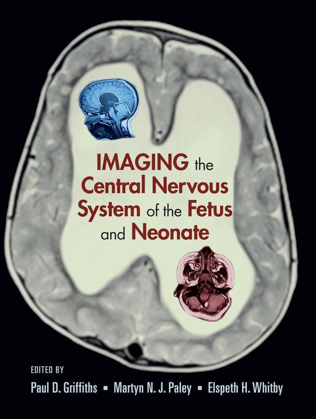 Imaging the Central Nervous System of the Fetus and Neonate by Elspeth H. Whitby, Martyn N.J. Paley, Paul D. Griffiths
