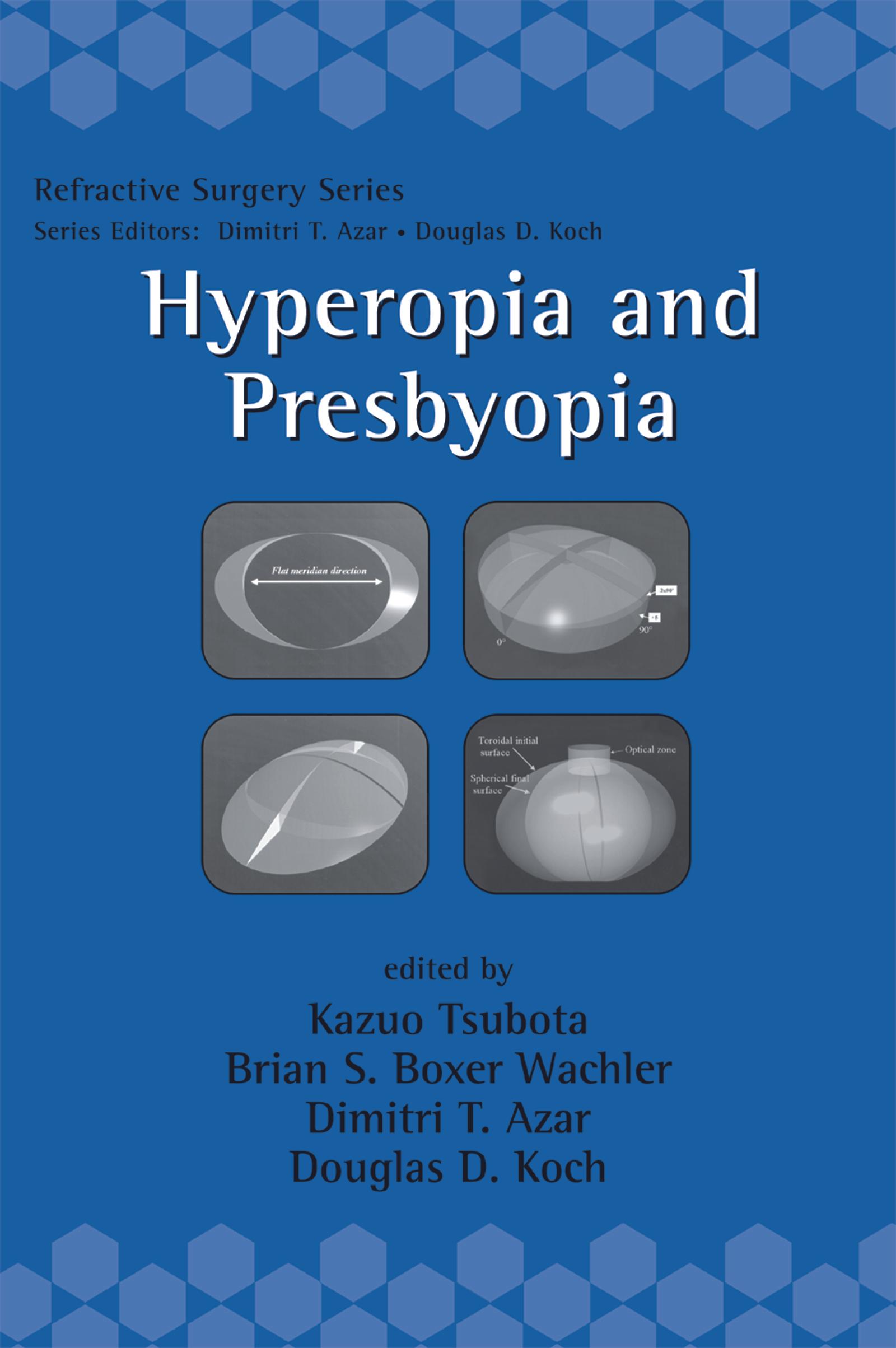 Hyperopia and Presbyopia