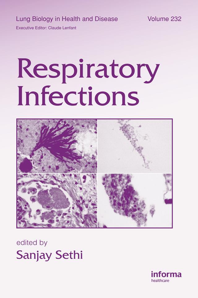 Respiratory Infections by Sanjay Sethi
