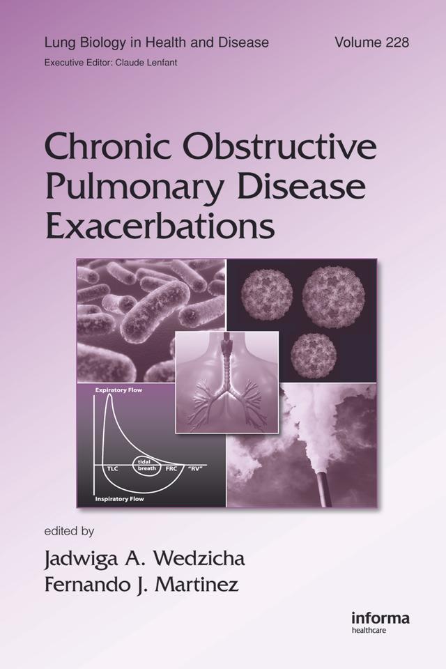 Chronic Obstructive Pulmonary Disease Exacerbations by Fernando J. Martinez, Jadwiga A. Wedzicha