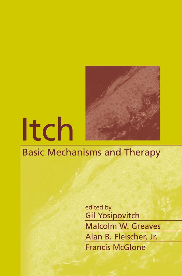 Itch by Francis McGlone, Gil Yosipovitch, Jr., Alan B. Fleischer, Malcolm W. Greaves