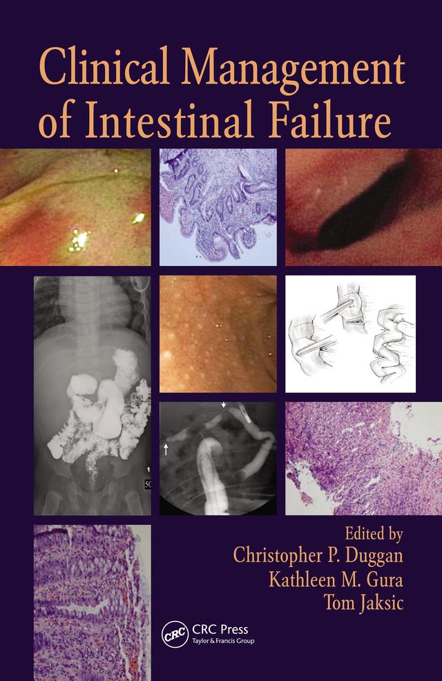 Clinical Management of Intestinal Failure by Christopher P. Duggan, Kathleen M. Gura, Tom Jaksic