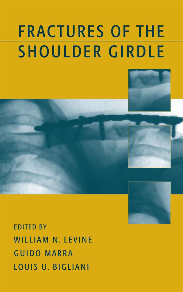 Fractures of the Shoulder Girdle by Guido Marra, William N. Levine