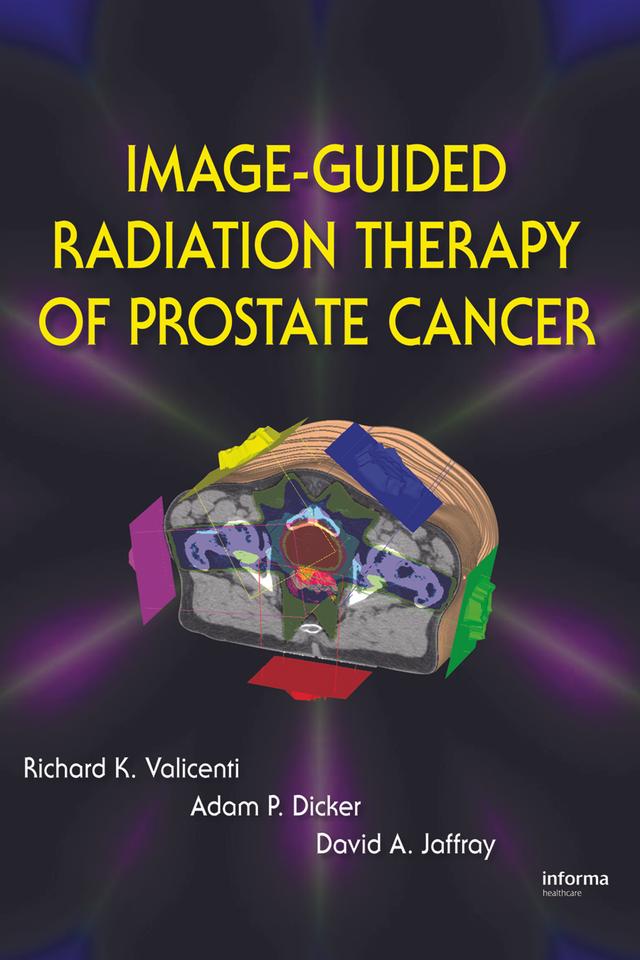 Image-Guided Radiation Therapy of Prostate Cancer by Adam P. Dicker, David A. Jaffray, Richard K. Valicenti