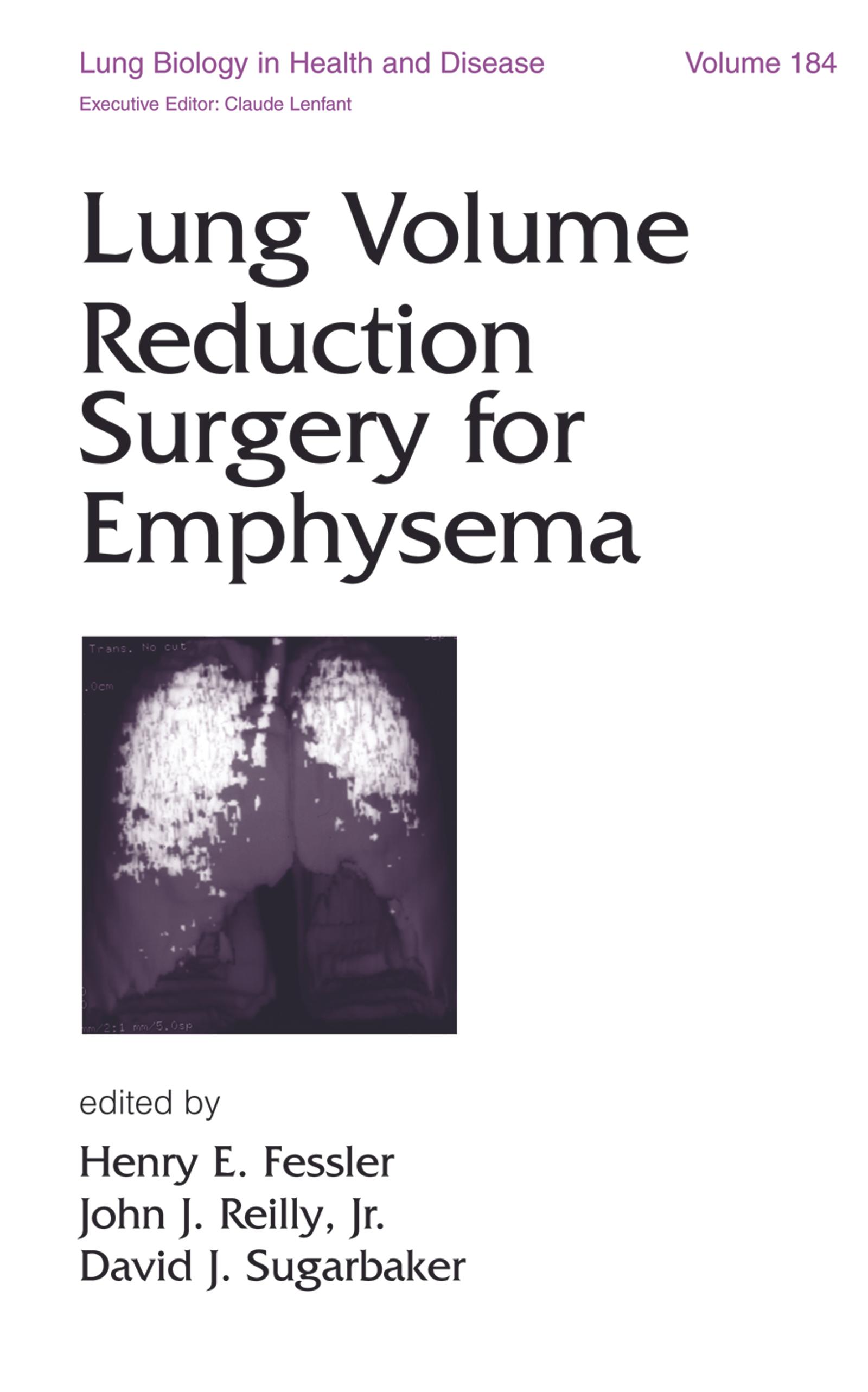 Lung Volume Reduction Surgery for Emphysema