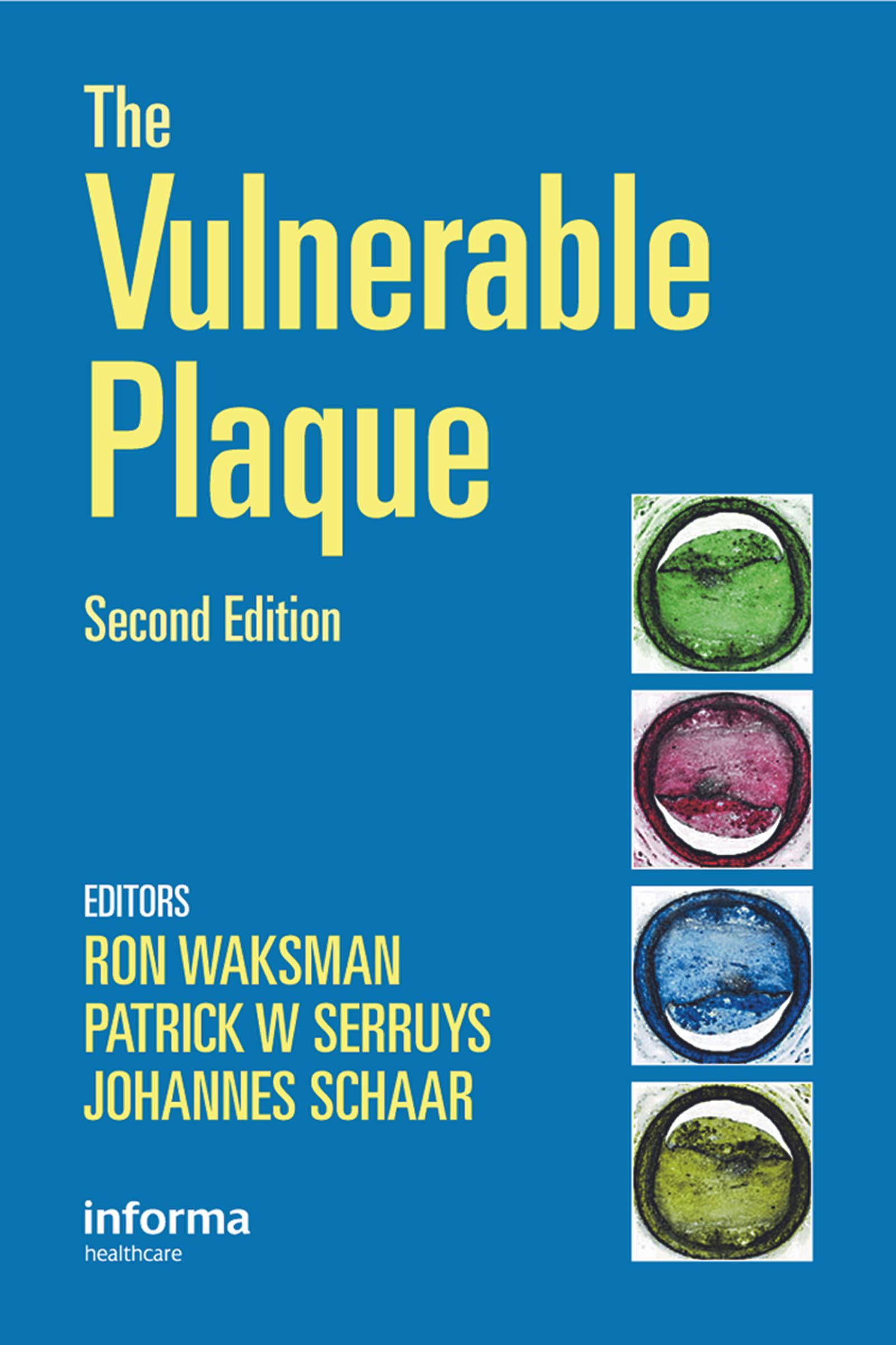 Handbook of the Vulnerable Plaque