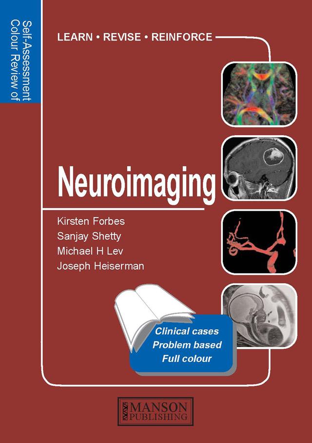 Neuroimaging by Joseph Heiserman, Kirsten Forbes, Michael Lev, Sanjay Shetty