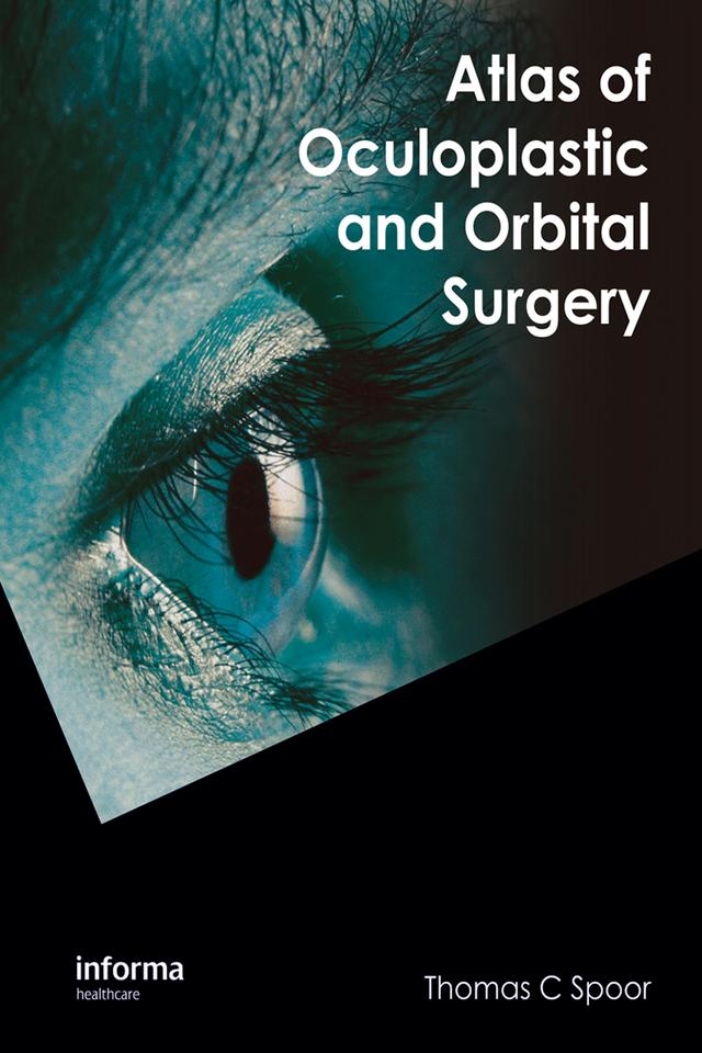 Atlas of Oculoplastic and Orbital Surgery by Thomas C. Spoor