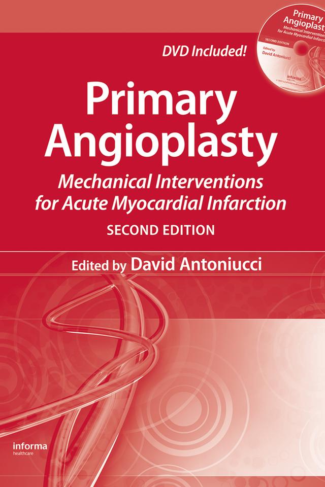 Primary Angioplasty by David Antoniucci