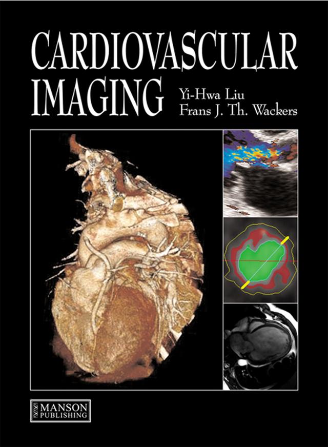 Cardiovascular Imaging by Frans Wackers, Yi-Hwa Liu