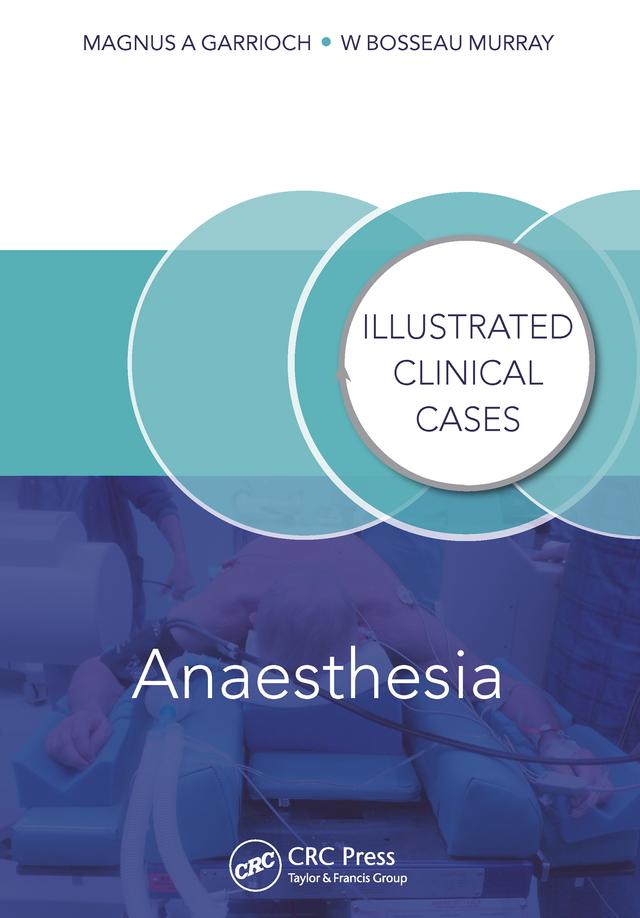 Anaesthesia by Bosseau Murray, Magnus Garrioch