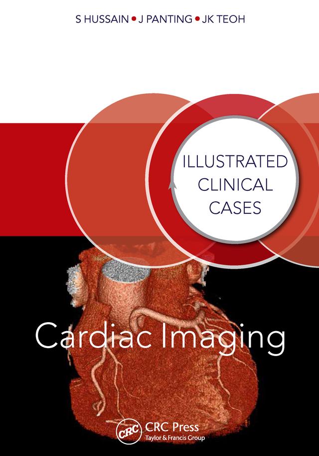 Cardiac Imaging by Jonathan Panting, Jun Kiat Teoh, Shahid Hussain