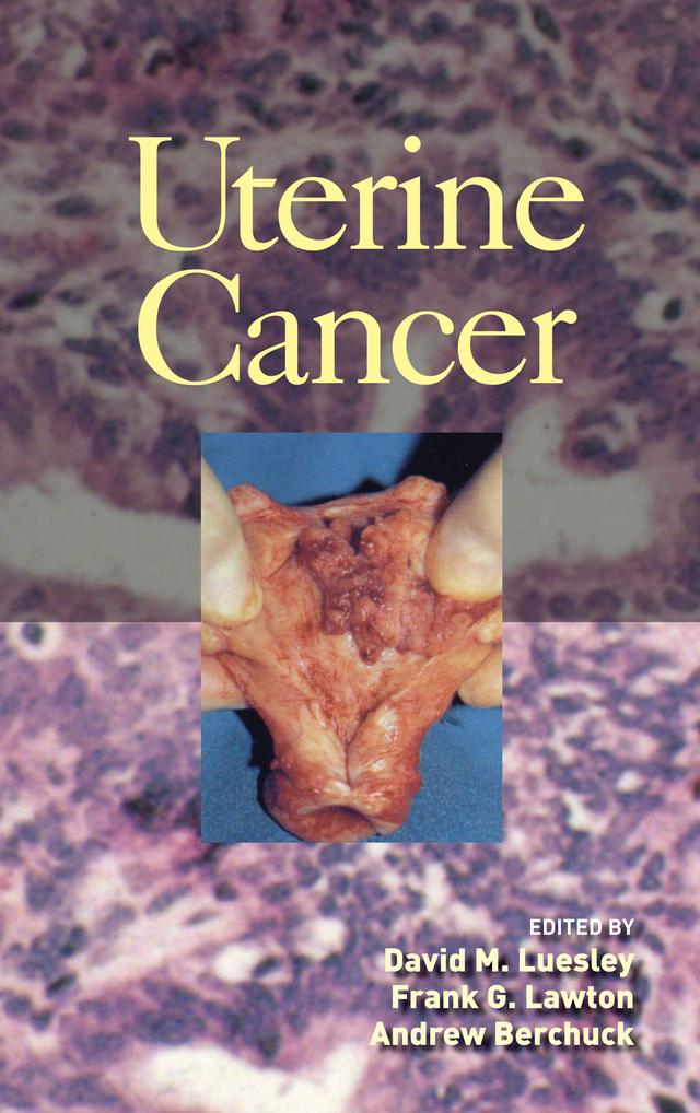 Uterine Cancer by Andrew Berchuck, David M. Luesley, Frank Lawton