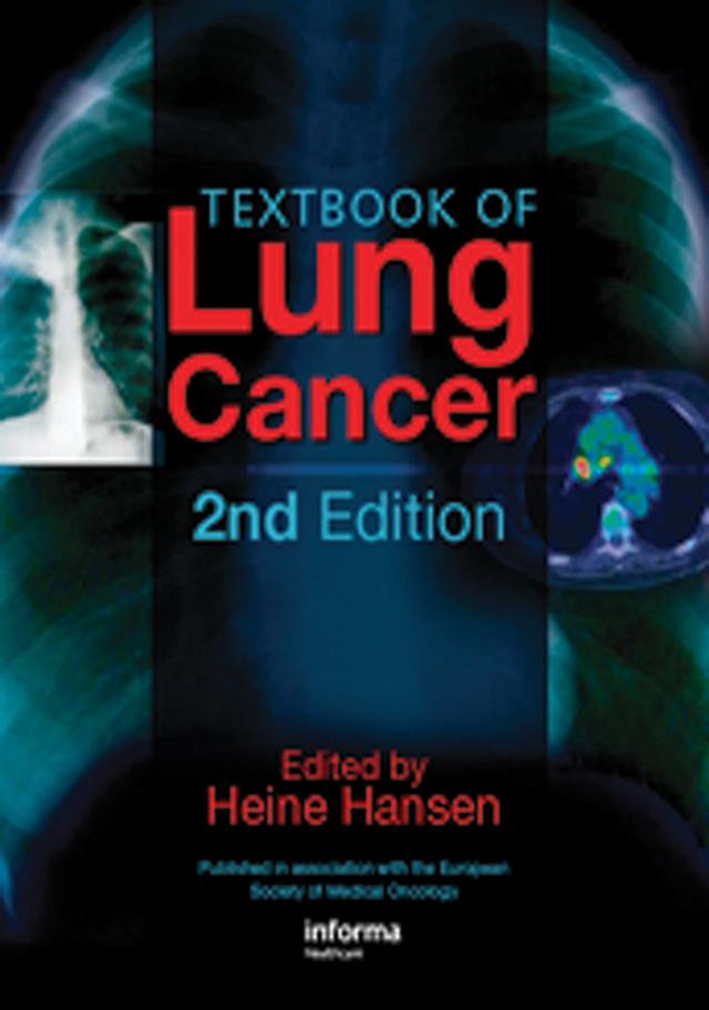 Textbook of Lung Cancer by Heine Hansen