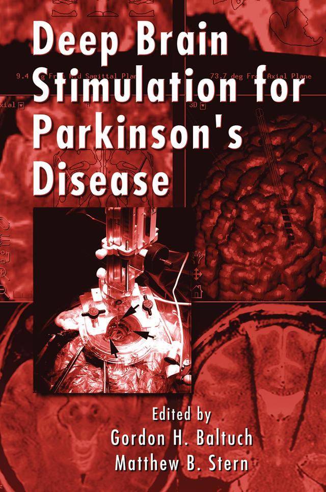 Deep Brain Stimulation for Parkinson's Disease by Gordon H. Baltuch, Matthew B. Stern