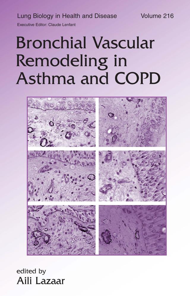 Bronchial Vascular Remodeling in Asthma and COPD by Aili Lazaar