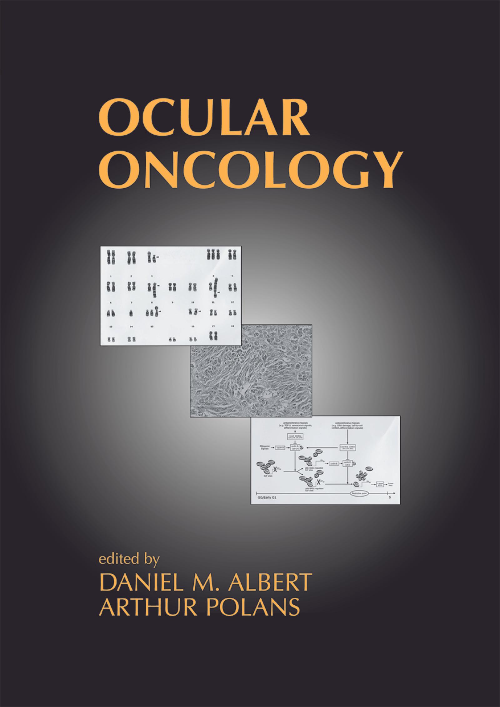 Ocular Oncology