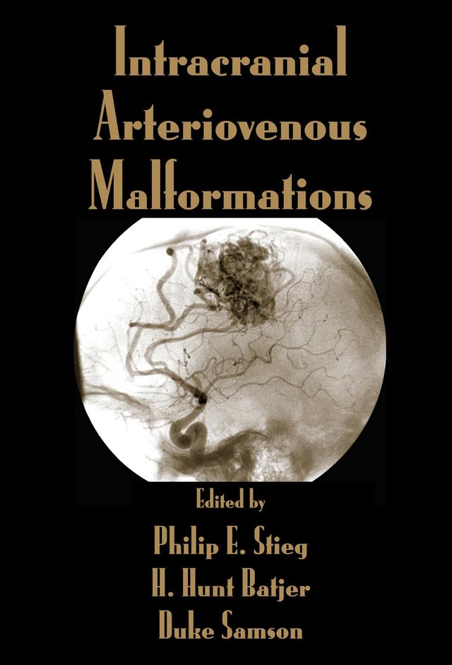 Intracranial Arteriovenous Malformations by Duke Samson, H. Hunt Batjer, Philip E. Stieg
