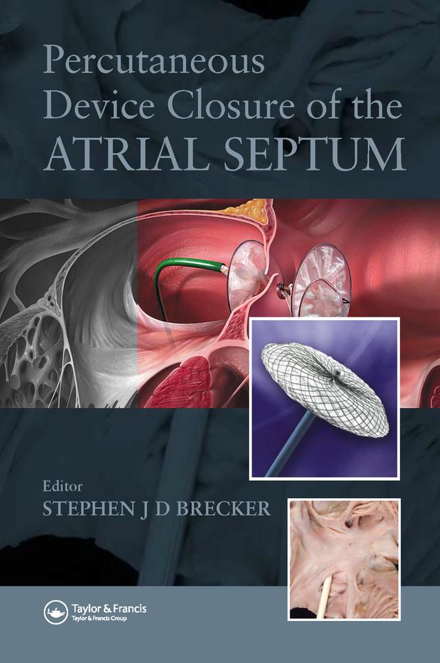 Percutaneous Device Closure of the Atrial Septum by Stephen Brecker