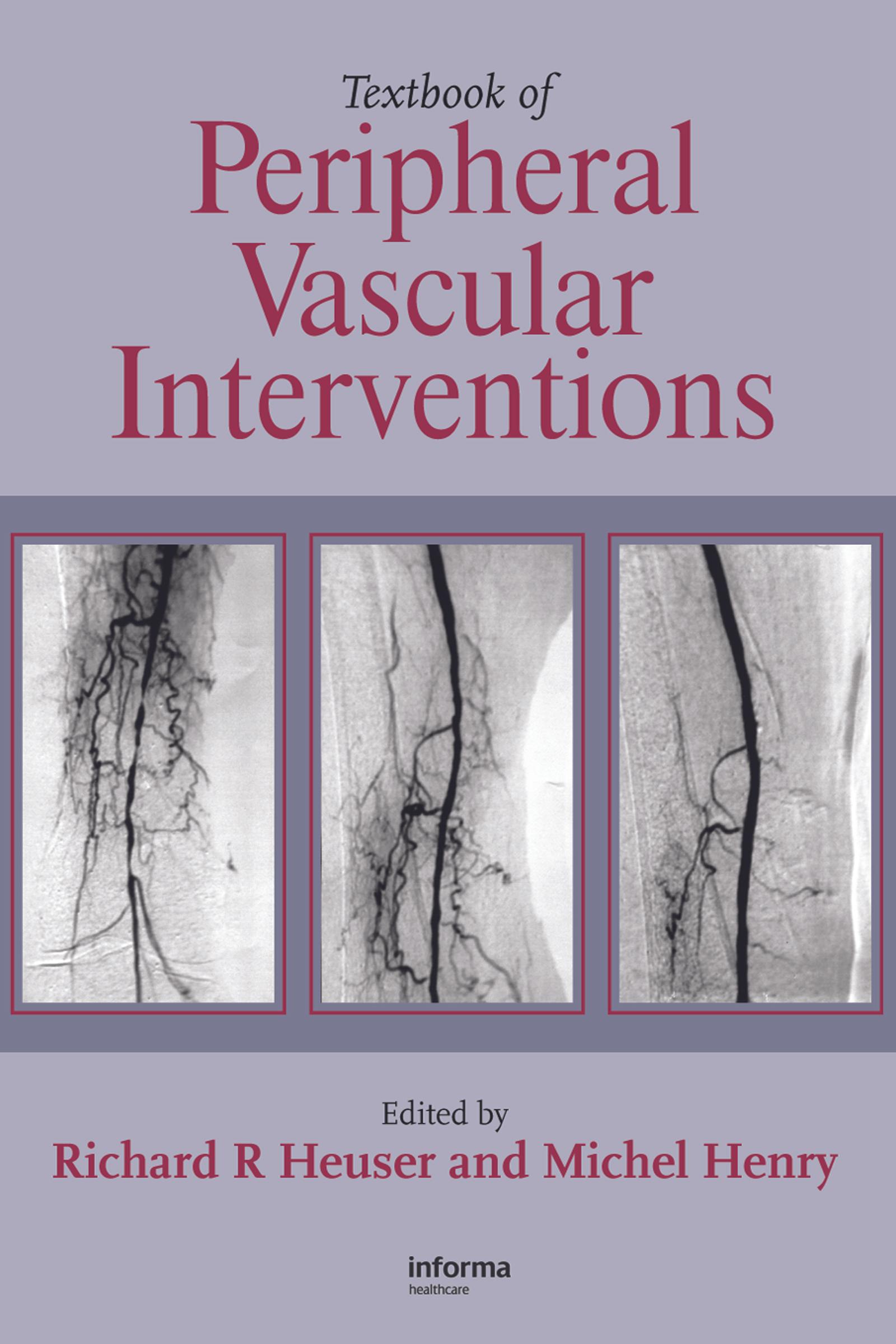 Textbook of Peripheral Vascular Interventions